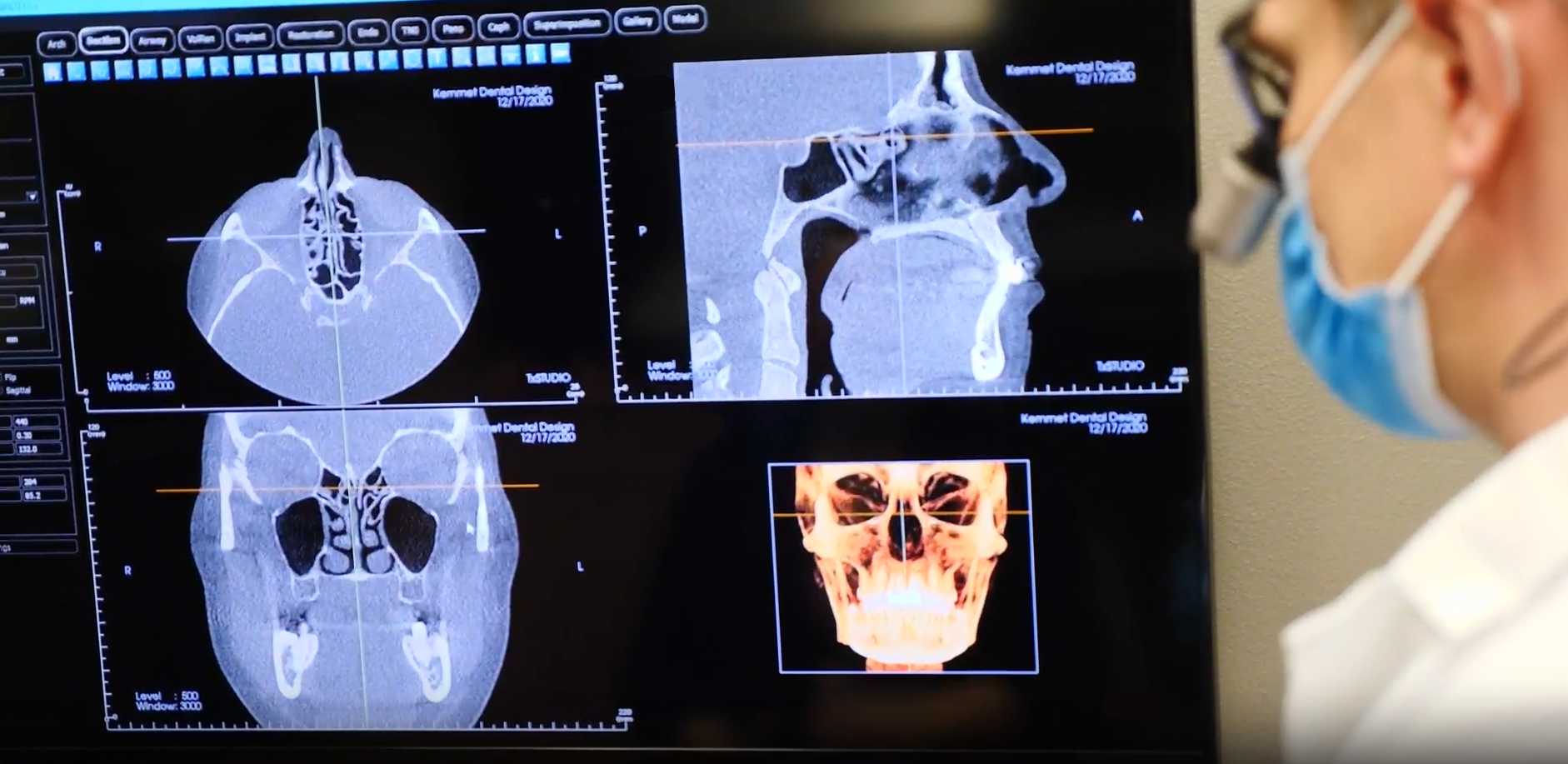 dental implants video overlay